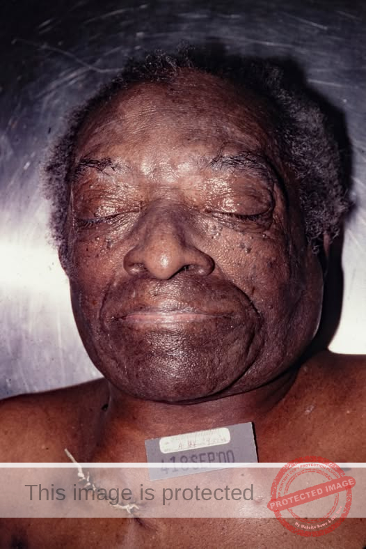 Unidentified Male Found in Chicago in 1992, Dies in 2000; Investigation Continues