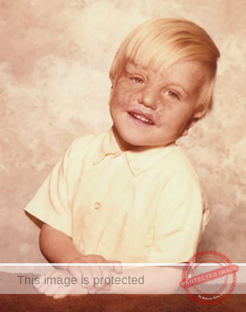 Keith Edmonds: From Survivor to Advocate – A Story of Resilience and Hope